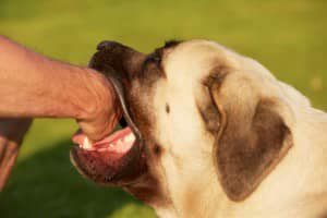 Dog biting a child because increased warm weather makes dogs more aggressive.