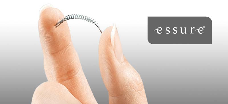 essure side effects